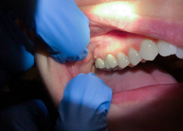 Best Emergency Treatment for Toothache in Simsbury Center, CT